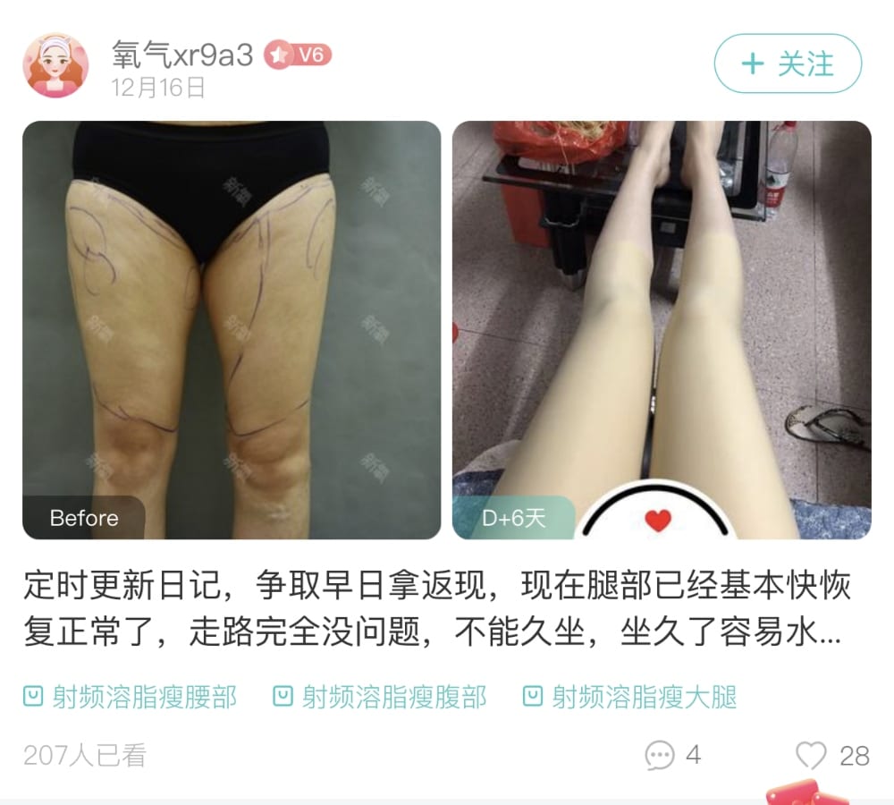 大量用家真實分享！大熱醫美專業「整形」APP