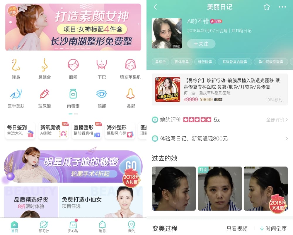 大量用家真實分享！大熱醫美專業「整形」APP