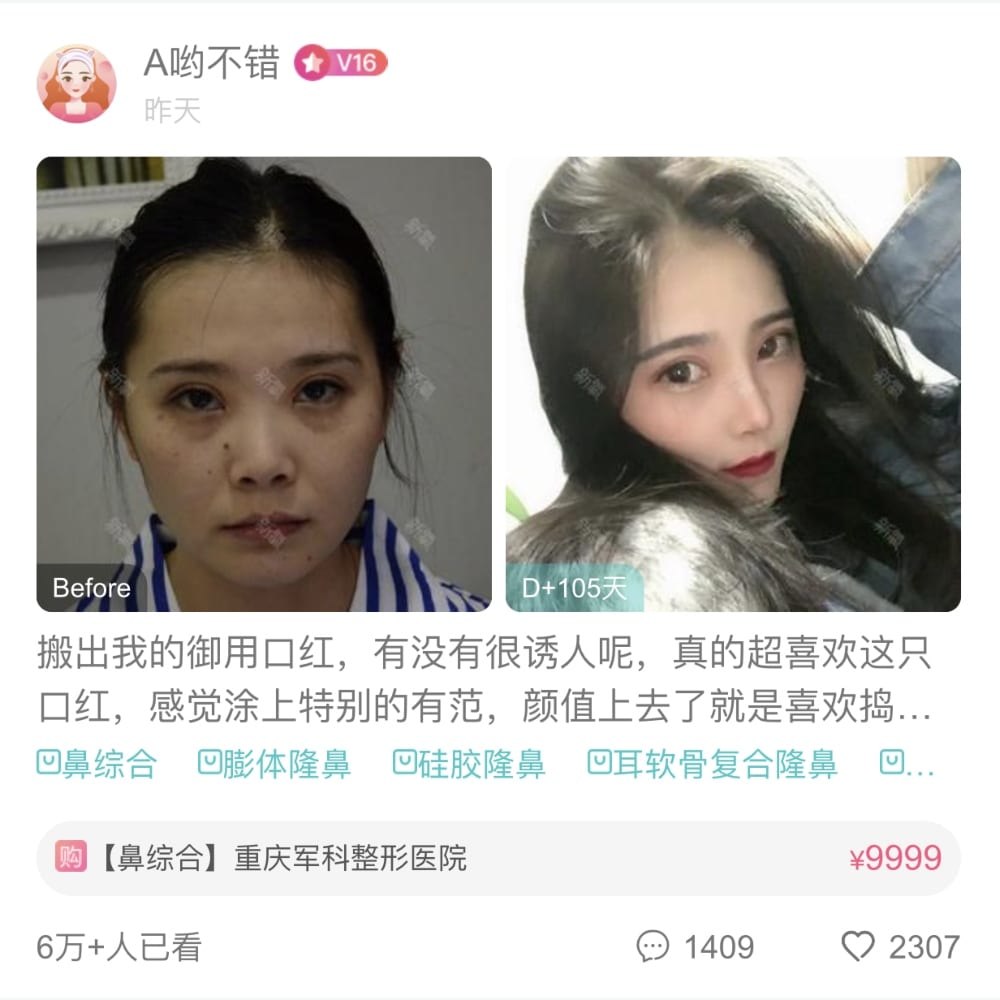 大量用家真實分享！大熱醫美專業「整形」APP