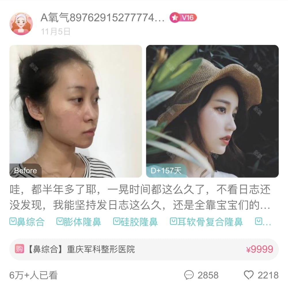 大量用家真實分享！大熱醫美專業「整形」APP
