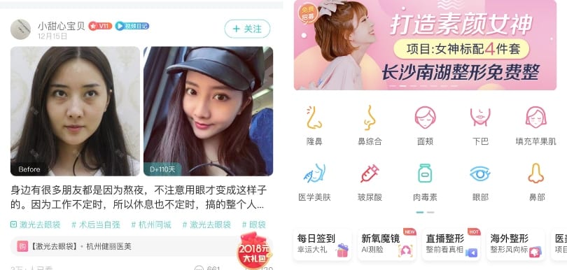 大量用家真實分享！大熱醫美整形APP分享整容日記