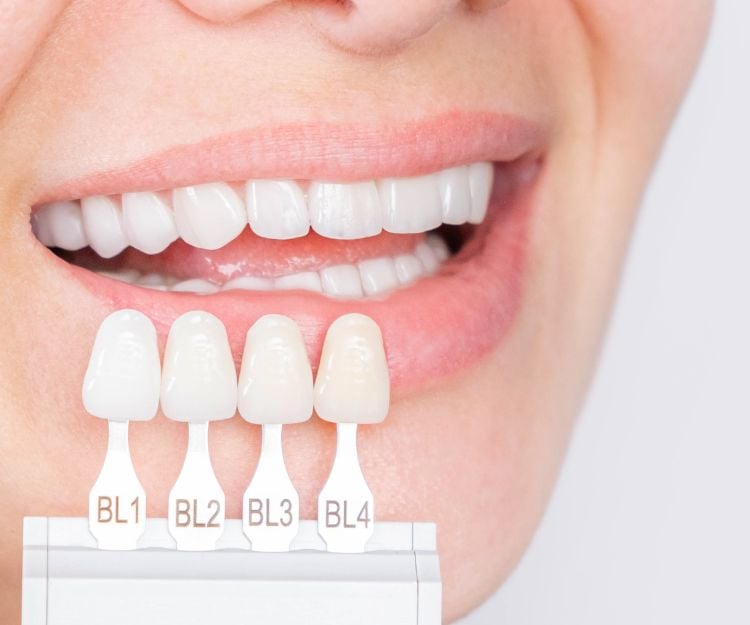 牙齒美容 牙齒美白 箍牙 牙套 牙貼片