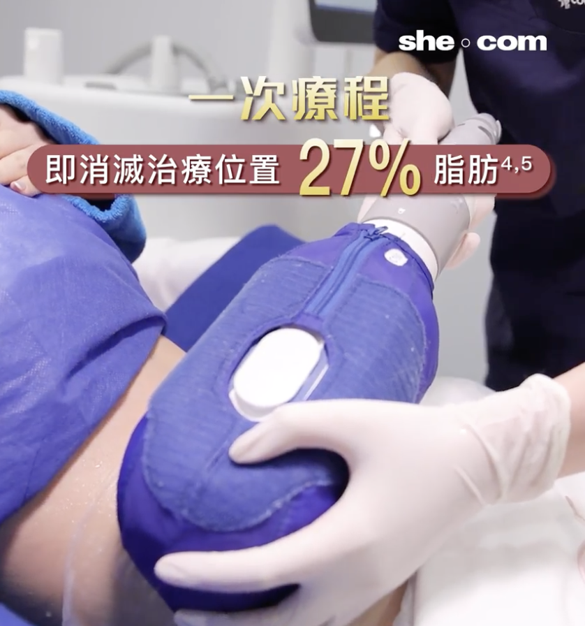 冷凍溶脂-perface-局部瘦身-減肥-coolsculpting