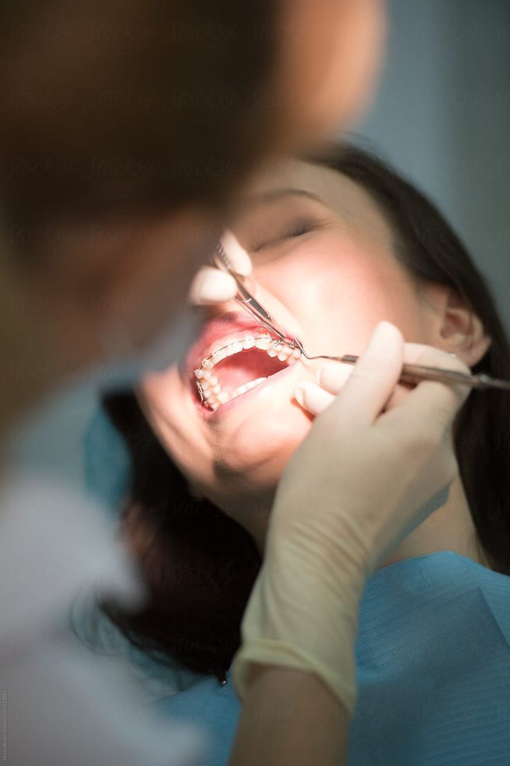 牙齒健康 日本研究-爛牙-護齒-腦退化