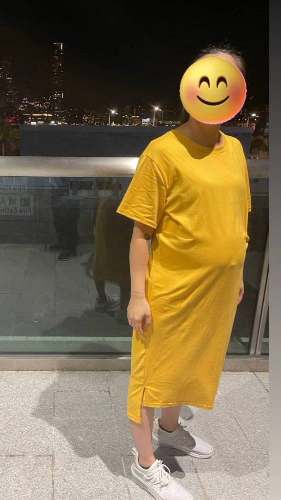 雯雯日前貼出孕照展示孕肚，不過就有網民見到她身形瘦削頭髮稀疏，擔心她營養不良。