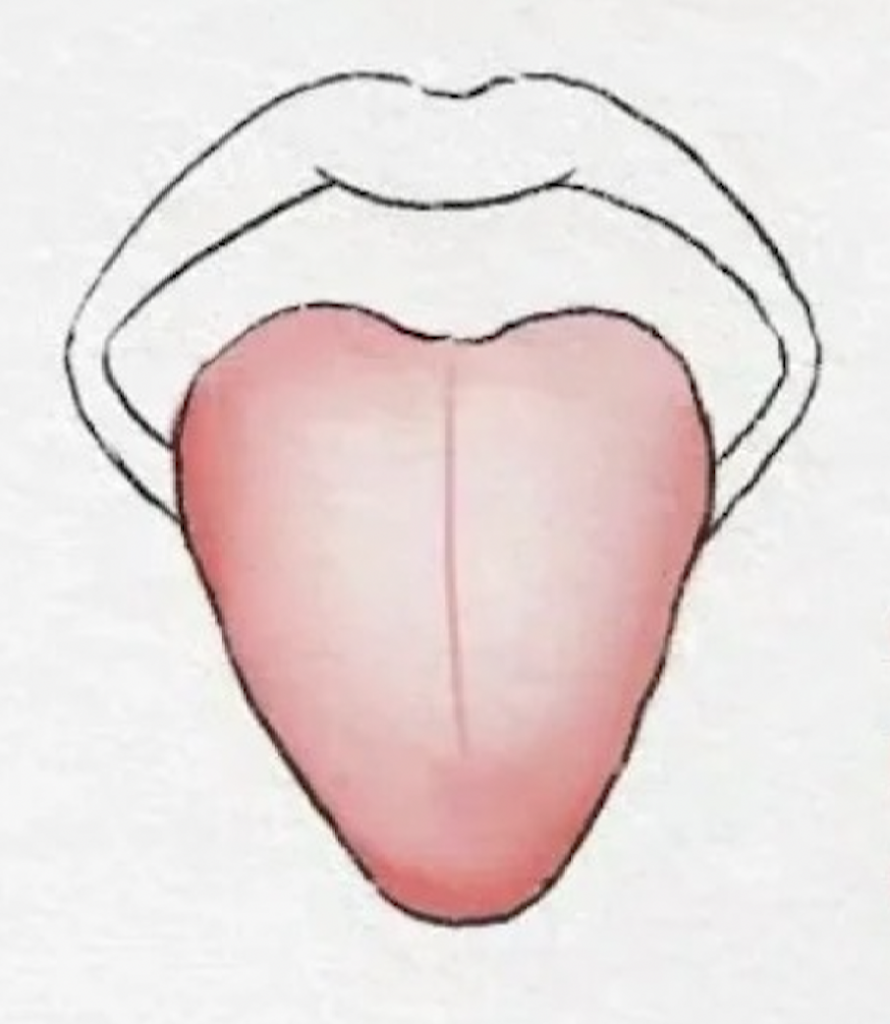 脷苔-顏色-健康-舌苔-舌頭