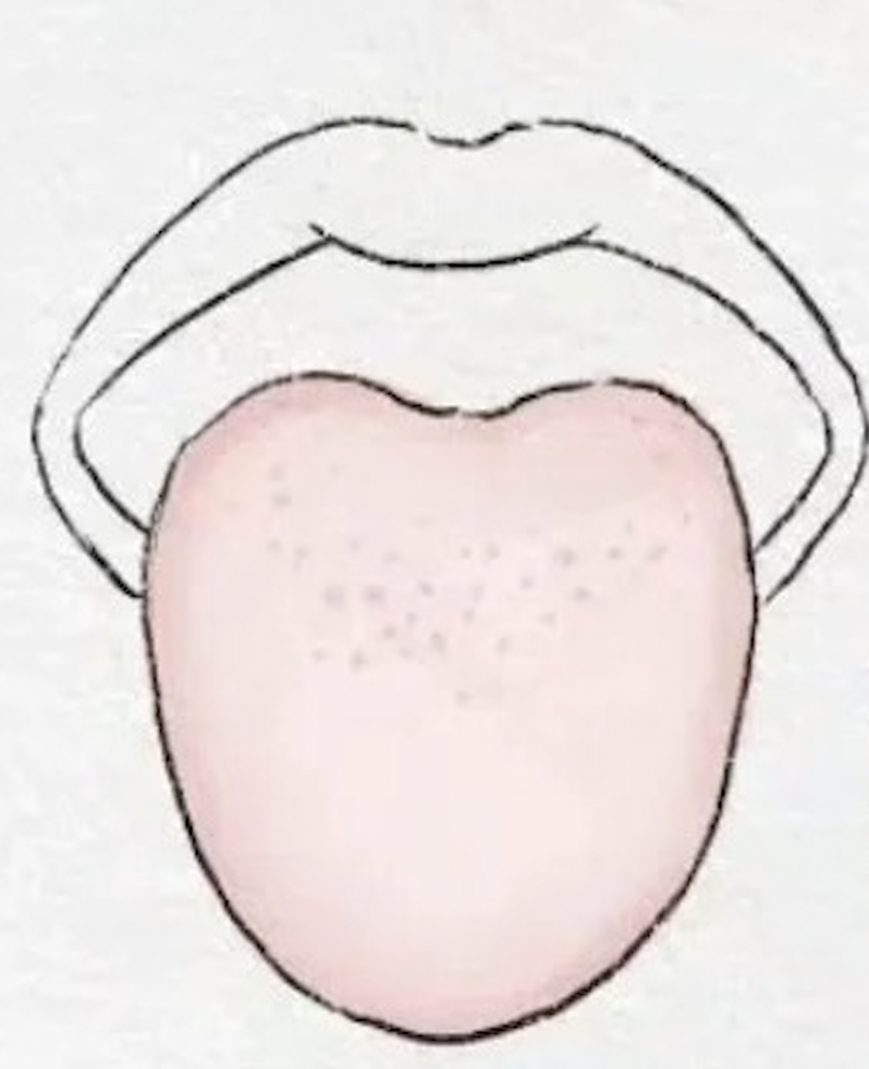 脷苔-顏色-健康-舌苔-舌頭