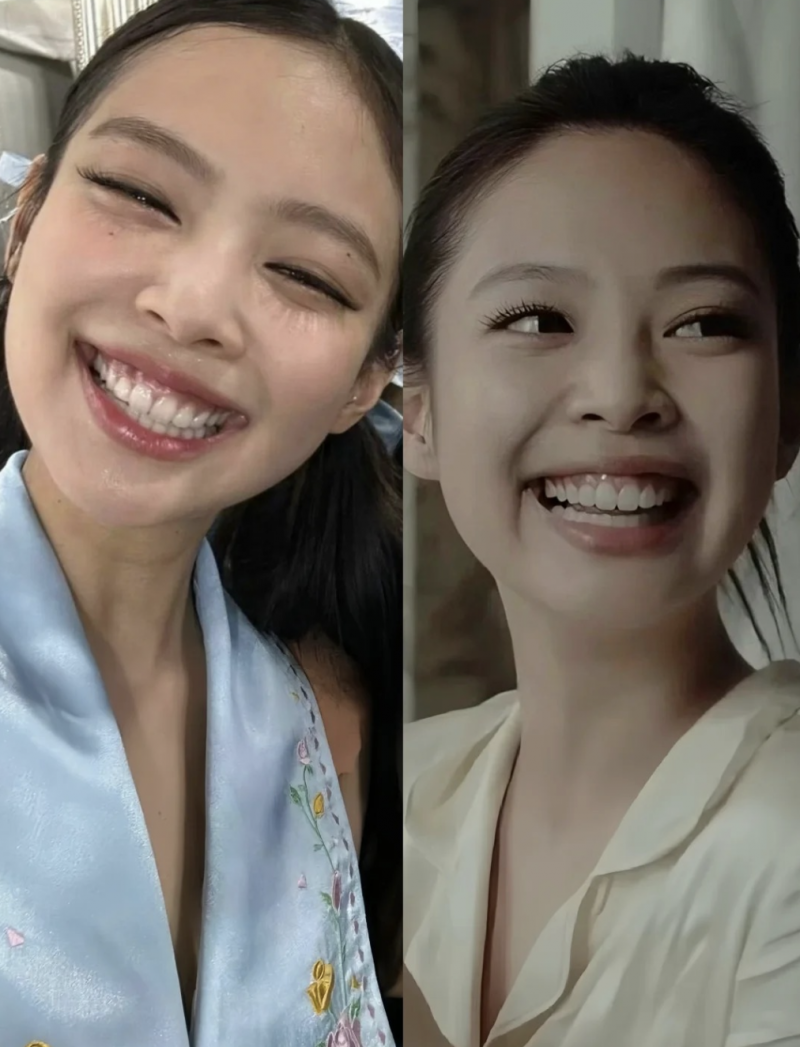 瓷牙貼片-牙貼片-牙齒美容