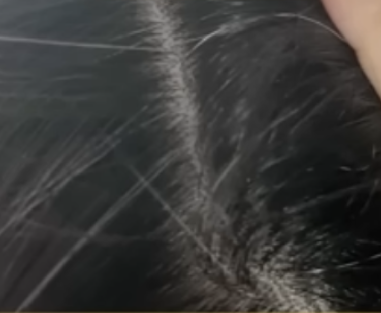 白髮比皺紋更顯老！不靠染讓黑髮自己生 真正視覺減齡！真實用家大讚：感覺年輕5歲