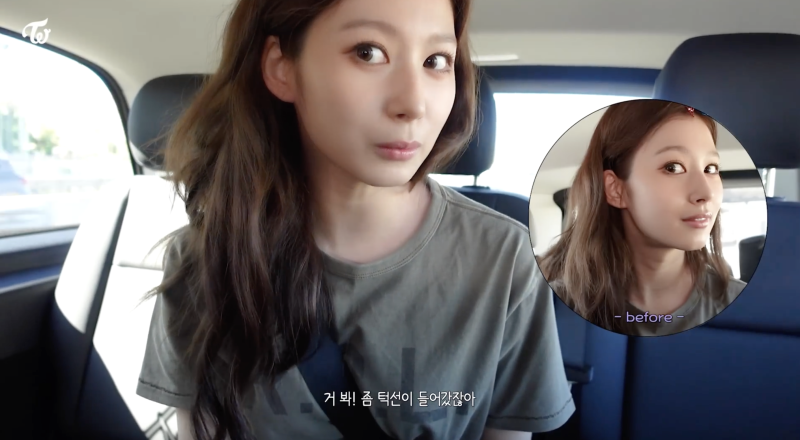 消水腫 浮腫 TWICE Sana