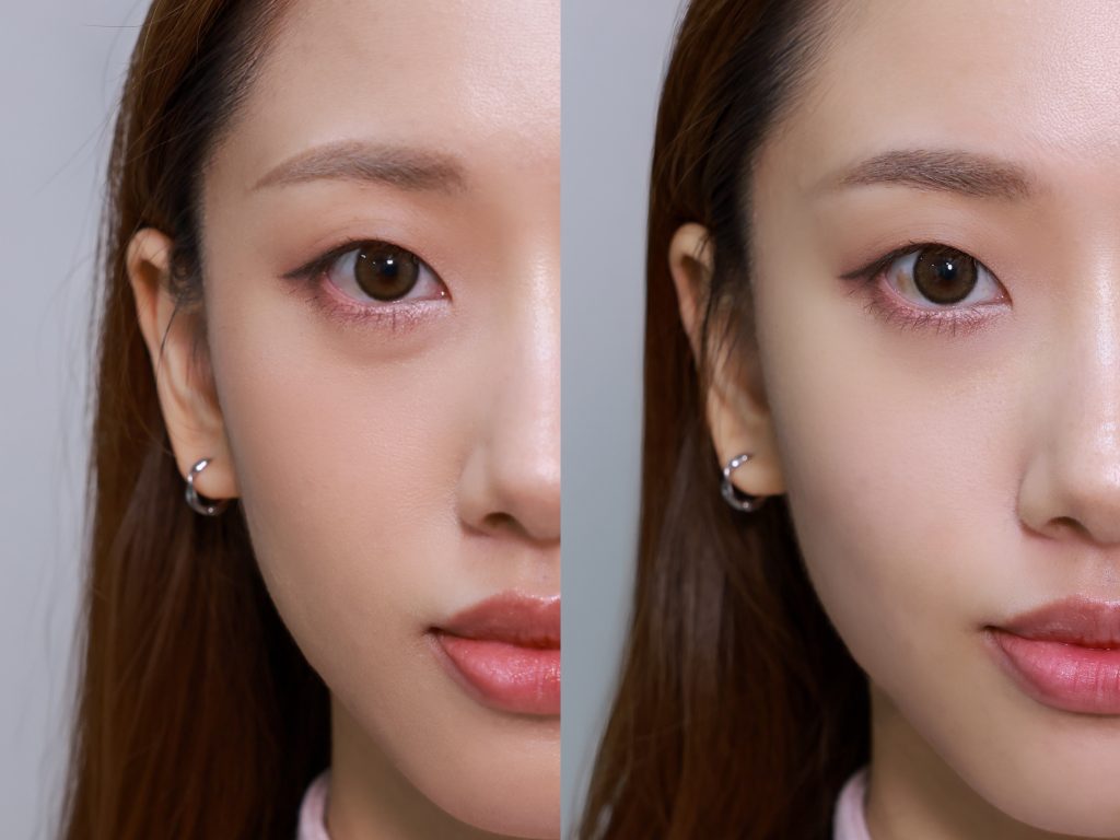 SkinReju 抗衰老 醫美