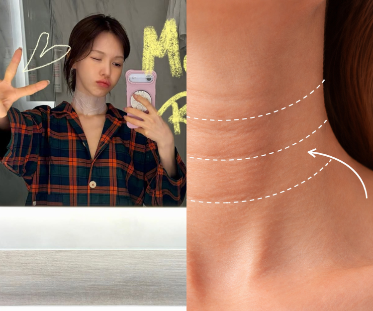 保養別只顧臉部！4大頸紋成因及預防方法一次看  避免1習慣讓紋路變深！