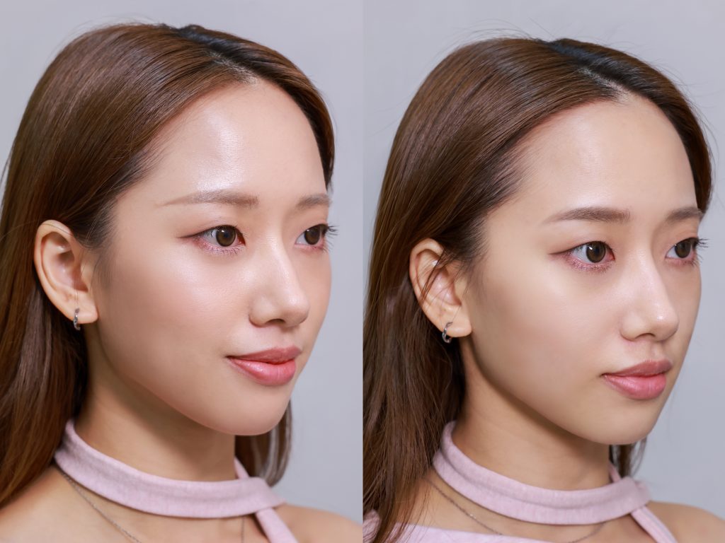 SkinReju 抗衰老 醫美