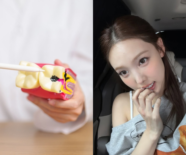 水果乾其實比糖果更傷牙？5 種毀牙食物 vs. 5 種護齒食物全清單