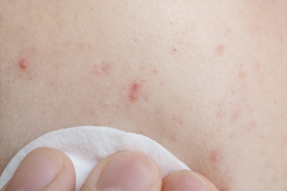 凡士林 凡士林用法 凡士林錯誤用法