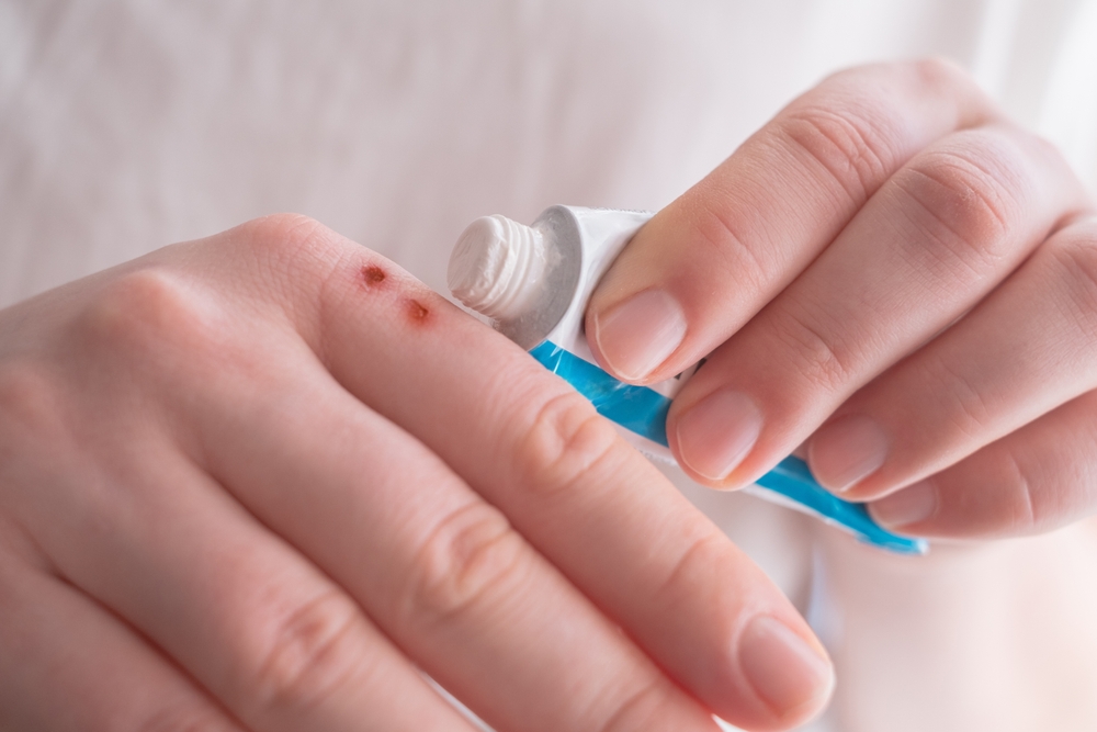 凡士林 凡士林用法 凡士林錯誤用法