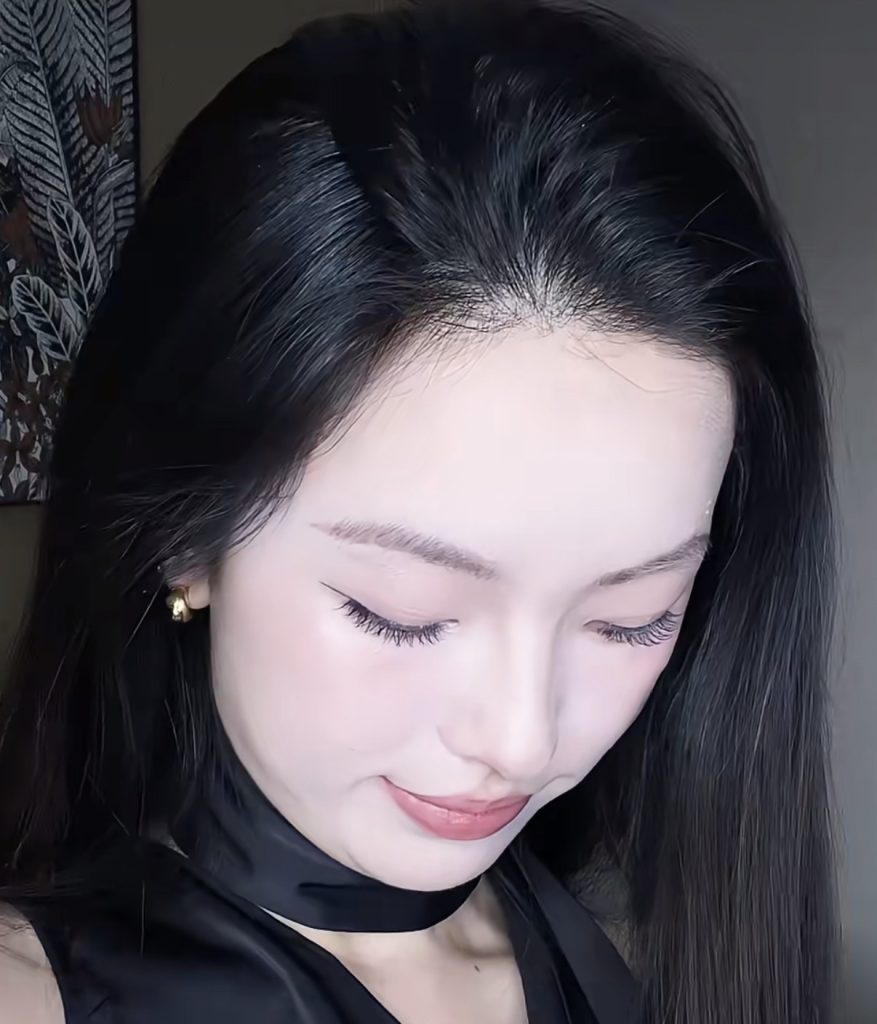 髮縫 縮髮縫 髮量