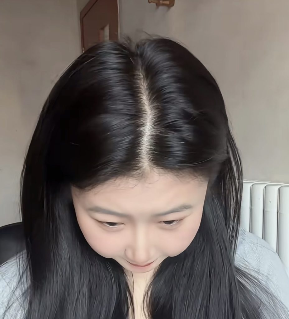 髮縫 縮髮縫 髮量