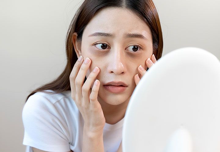 去眼袋-醫美-療程-整形-李泳知