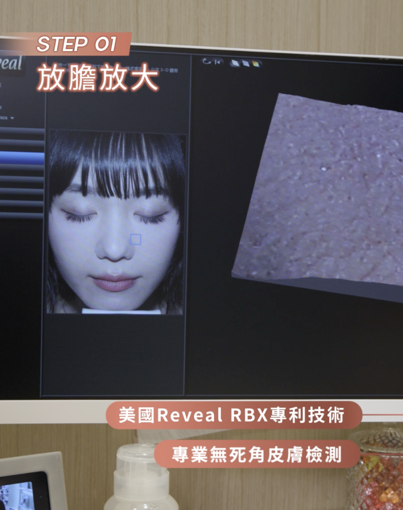 onlux-肌底覺醒-exosome療程-水光肌