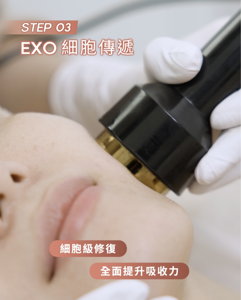 onlux-肌底覺醒-exosome療程-水光肌