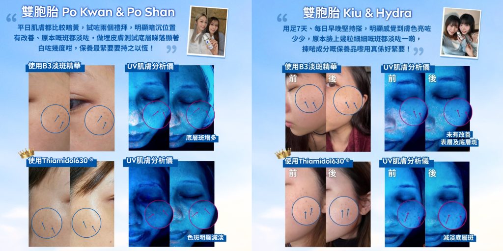 NIVEA 淡斑 美白