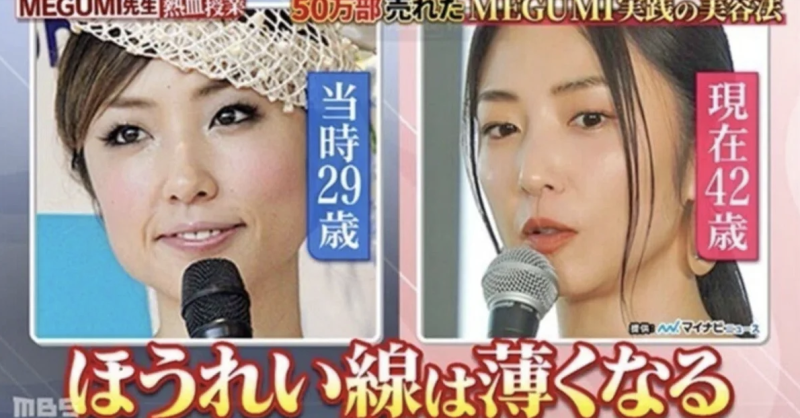 下顎線 提拉 抗老 法令紋