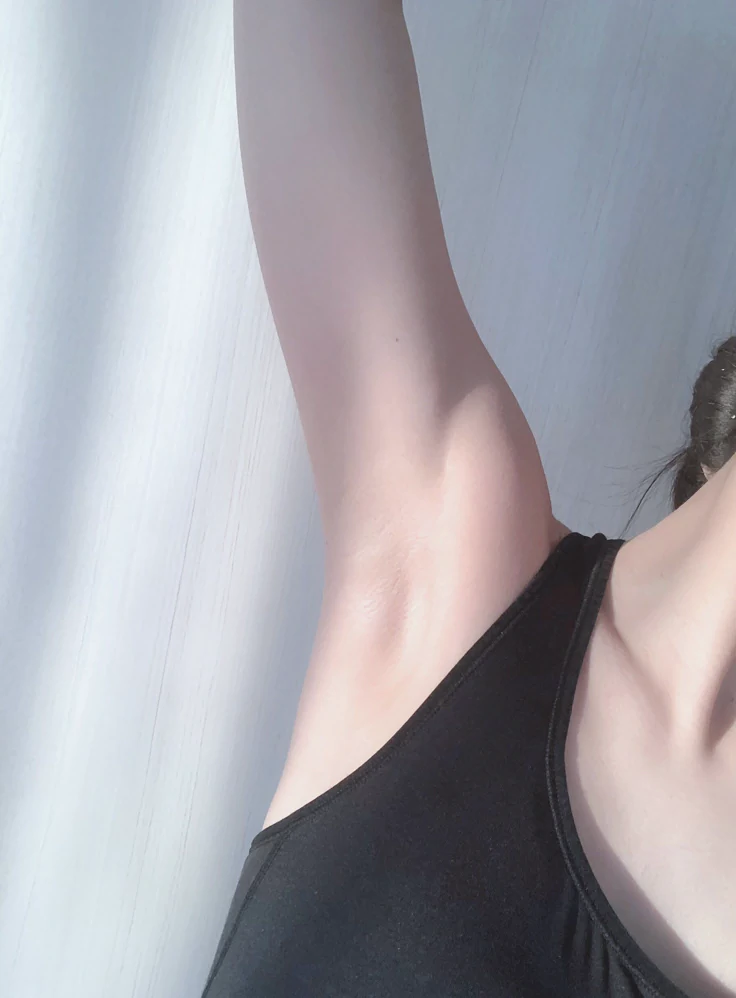 水楊酸 乳液 除臭 狐臭 腳臭