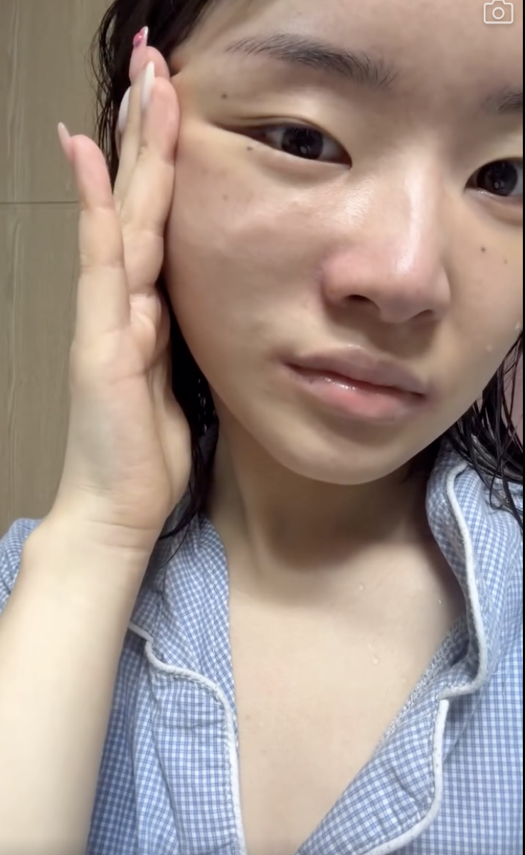 韓國醫美-juvelook-素顏針-膠原蛋白增生劑