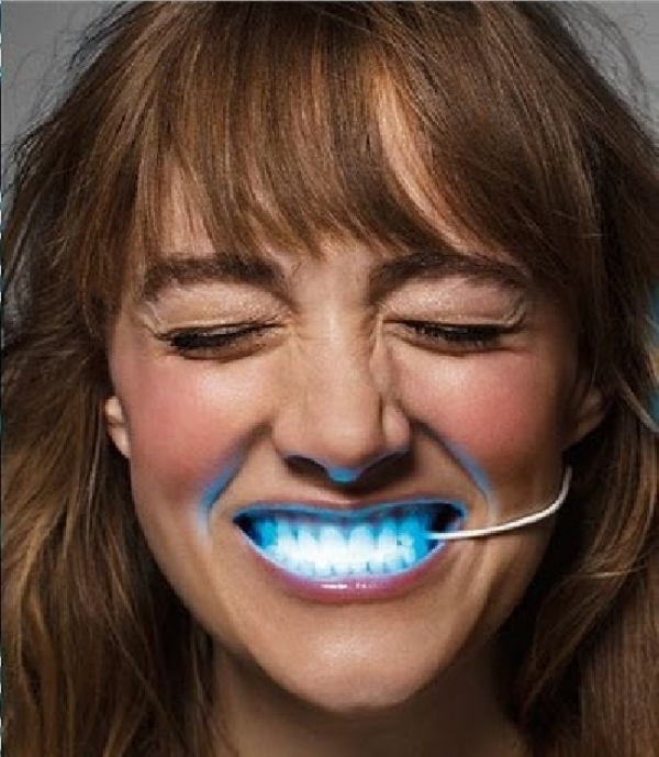 自家用！藍光牙齒美白療程