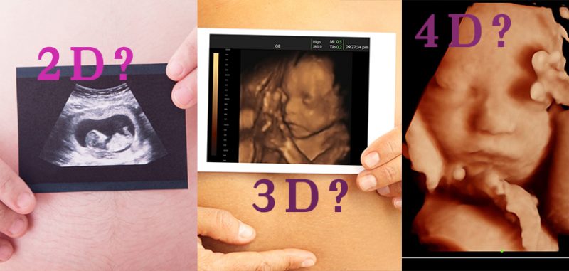 2d3d4d超聲波邊樣全面啲