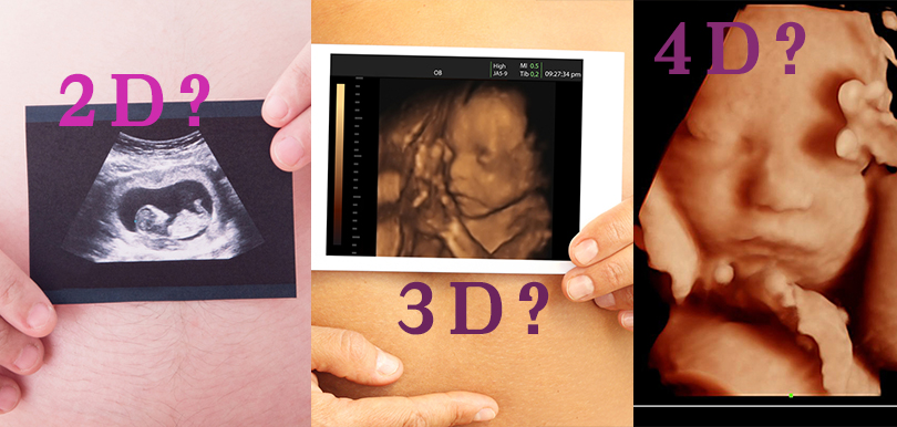 孕婦知多啲： 2D • 3D • 4D超聲波，邊樣全面啲？