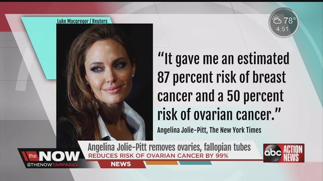angelina_jolie_pitt_has_ovaries__fallopi_2744750001_15500204_ver1-0_640_480
