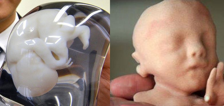 私院引入 3D 打印胎兒服務   你又 buy 唔 buy？