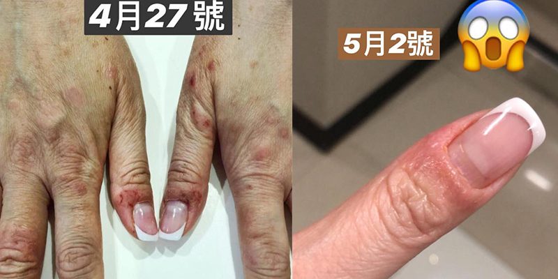 劉小慧教蛋黃油醫濕疹中醫教路可以制成膏狀放半年