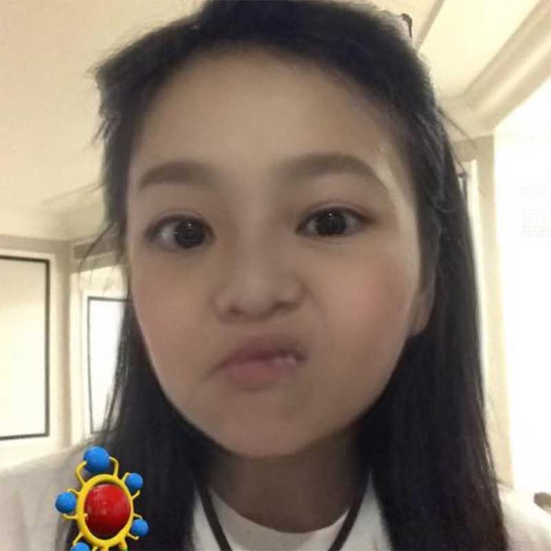 劉小慧用蛋黃油醫濕疹孕婦誤用或至畸胎