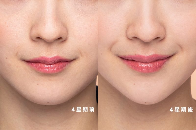 Clarins V輪廓緊緻精華
