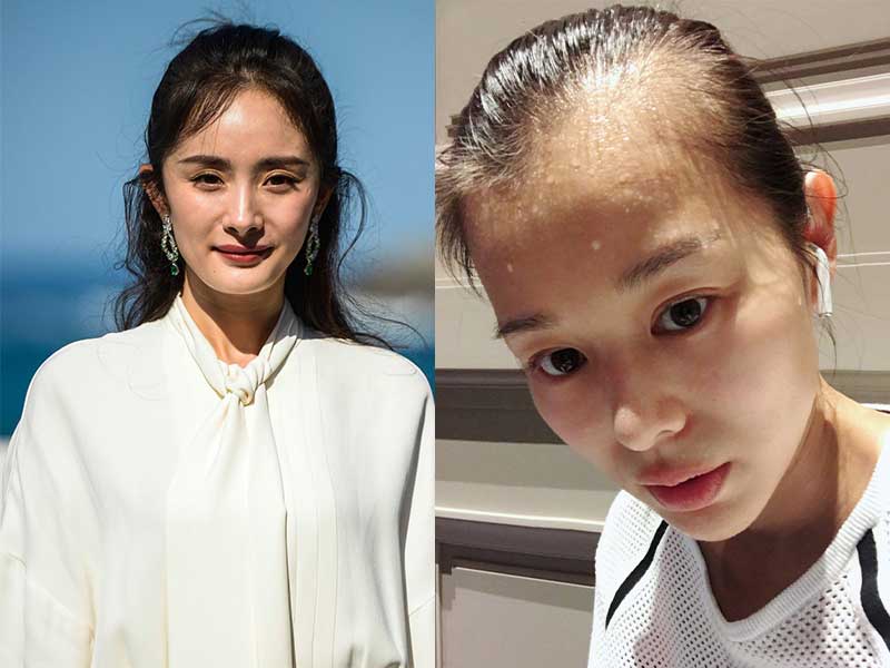 女人也有脫髮煩惱？ 三招拯救頭髮稀疏