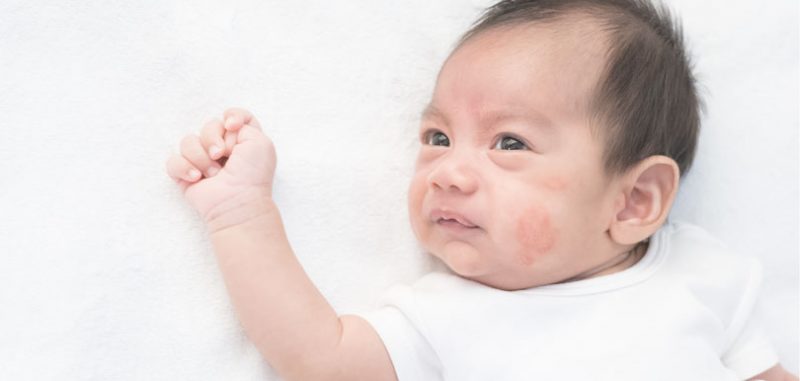 如何增加胎兒與BB免疫力？｜婦產科醫生方碧鎏