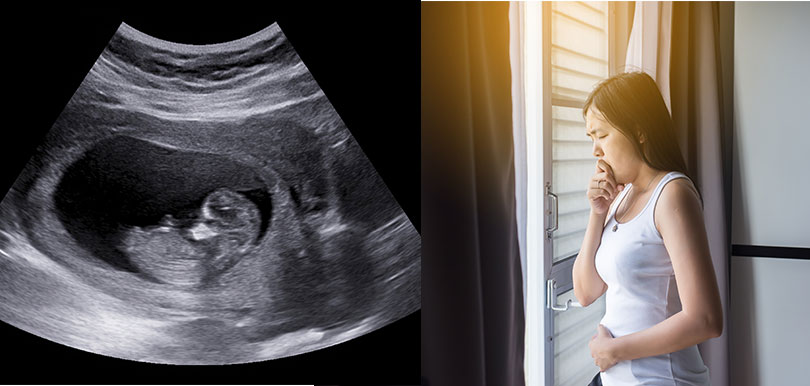 「先兆流產」要小心！中醫教路懷孕首三月注意安胎