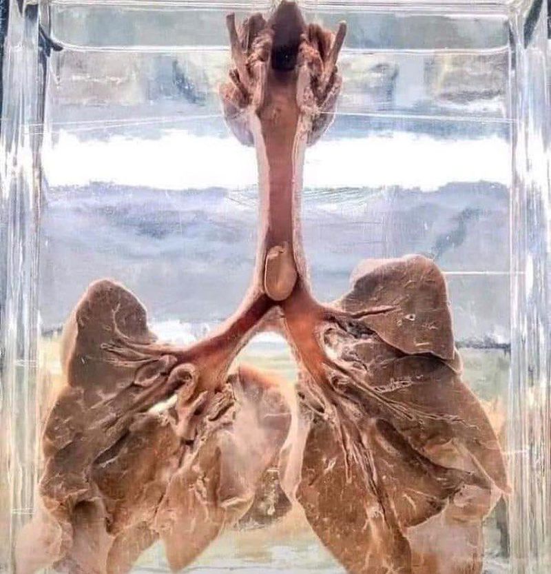 小朋友食嘢哽親點算好？6招教你小朋友哽親急救法