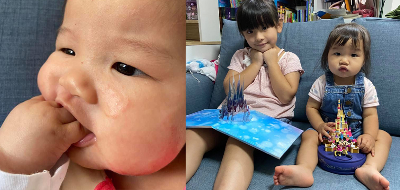 【BB濕疹】女兒皮膚滲出血水！媽媽不靠類固醇1招舒緩濕疹肌