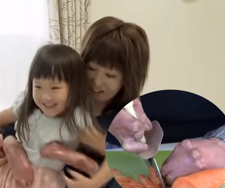 日本媽媽車禍為保1歲囡囡燒傷毀容　無懼傷殘養大女兒超感人