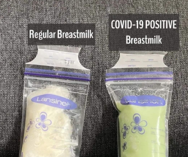 外國媽媽確診後母乳變綠色！確診後可以餵母乳嗎？