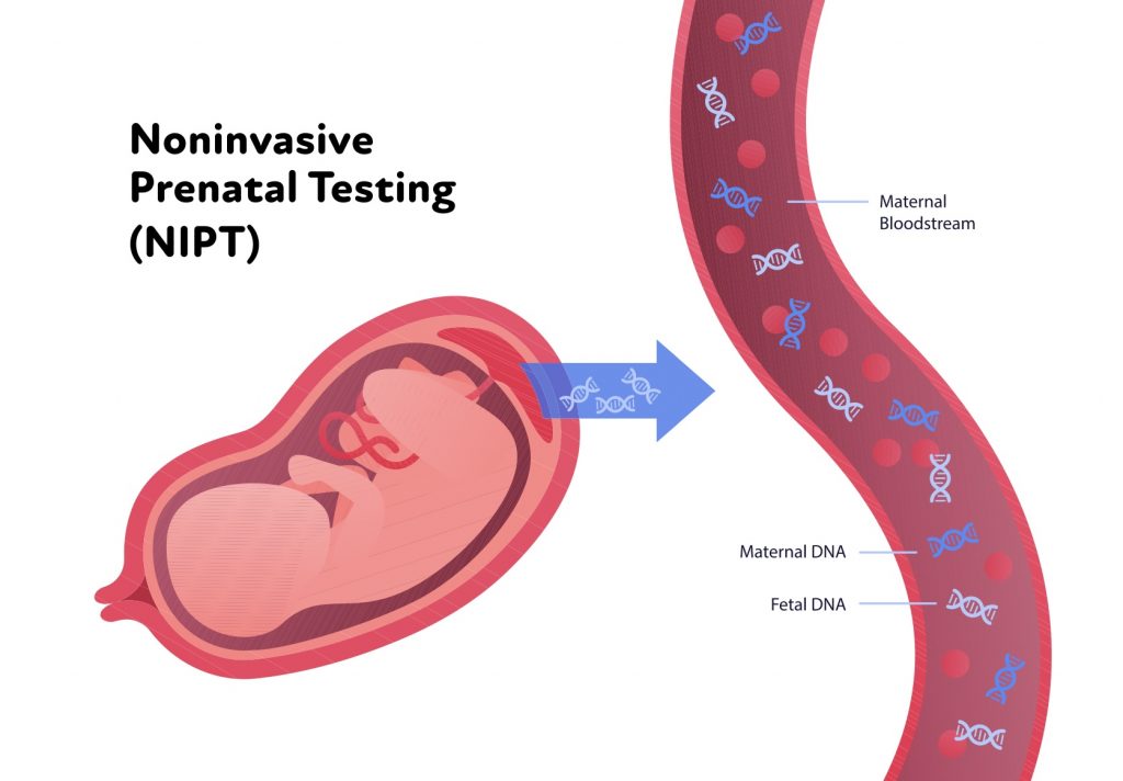染色體異常 NIPT Test