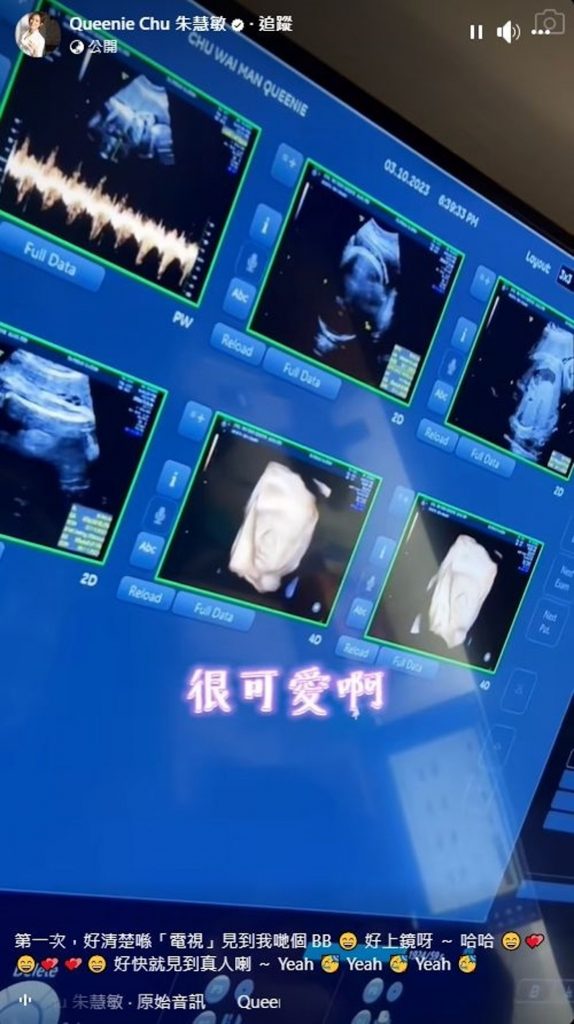 朱慧敏 懷孕 產前