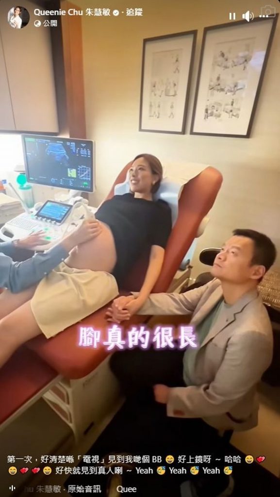 朱慧敏 懷孕 產前