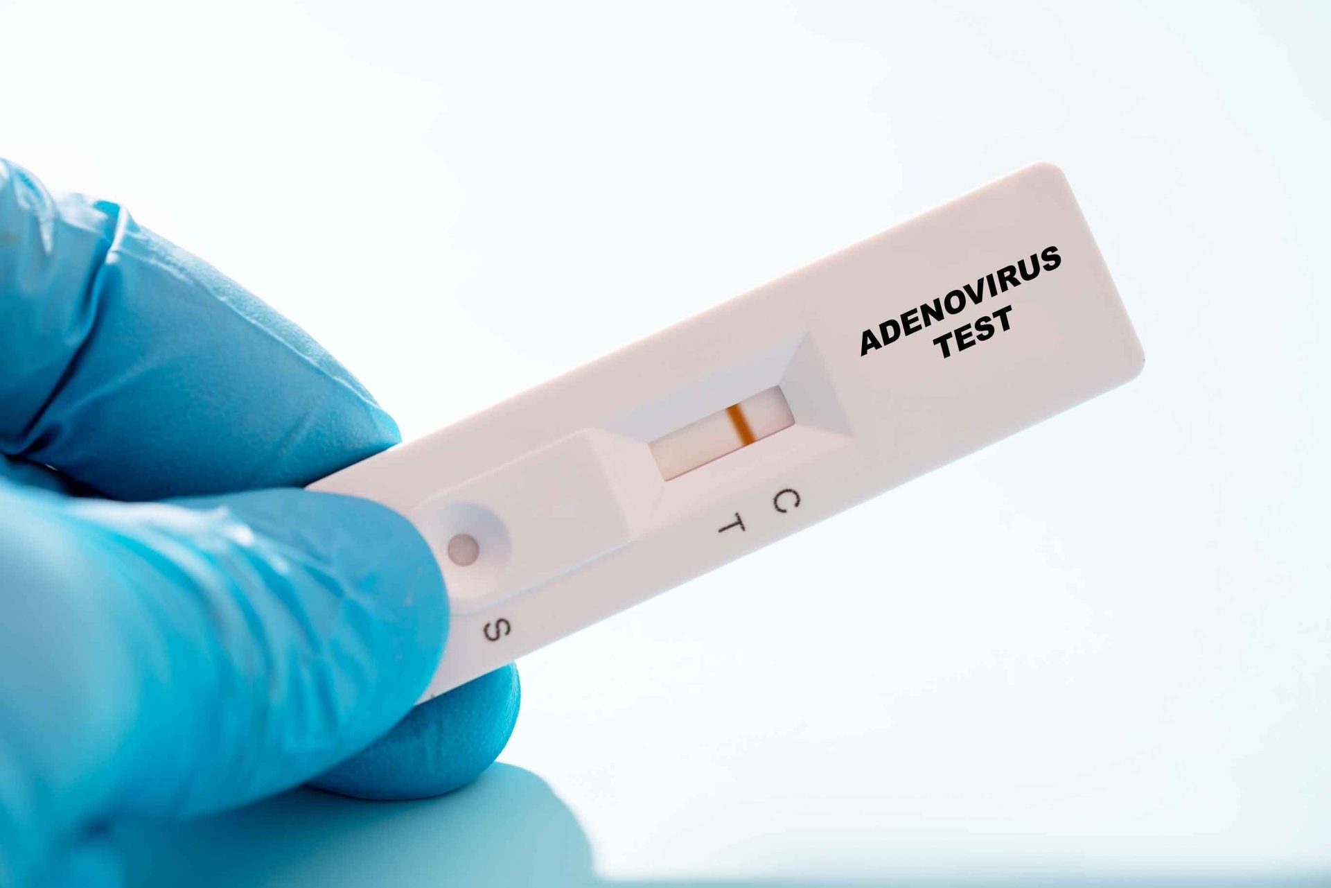 醫生有多種方法治療腺病毒，主要是紓援症狀，減輕身體不適。