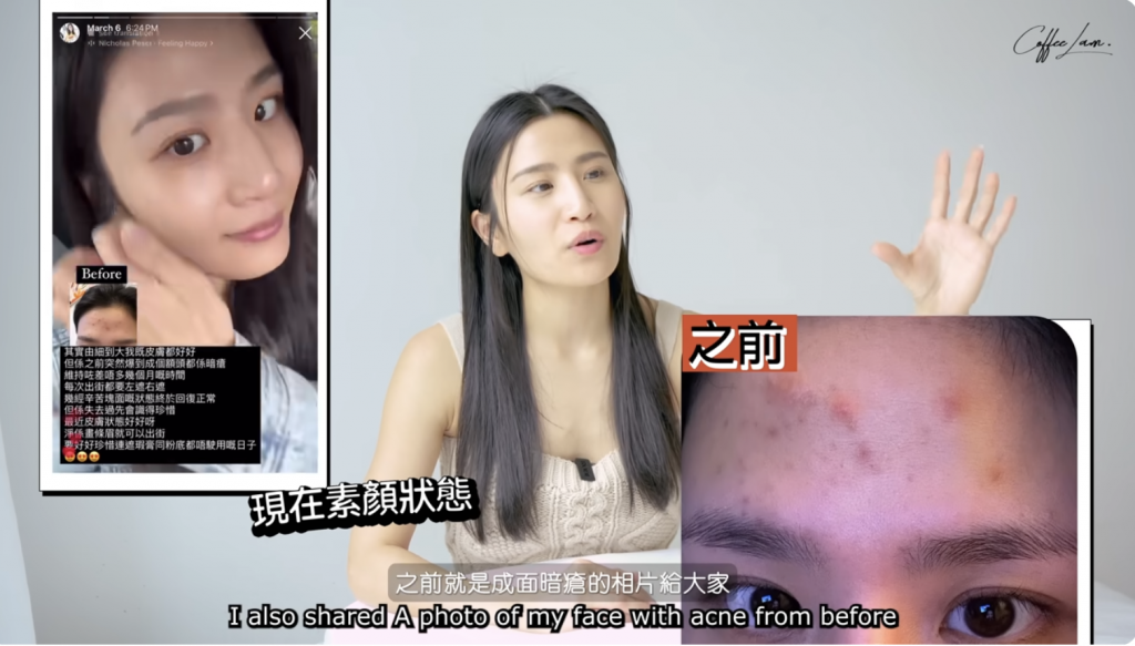 Coffee 林芊妤 暗瘡 中醫 備孕