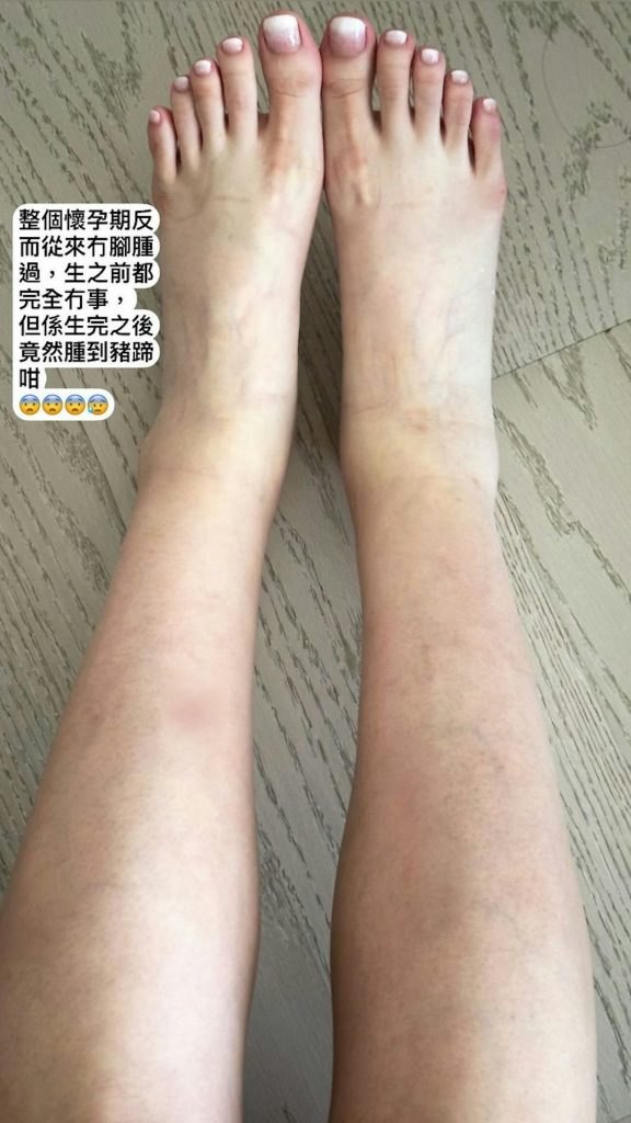 連詩雅 陳家樂 產後